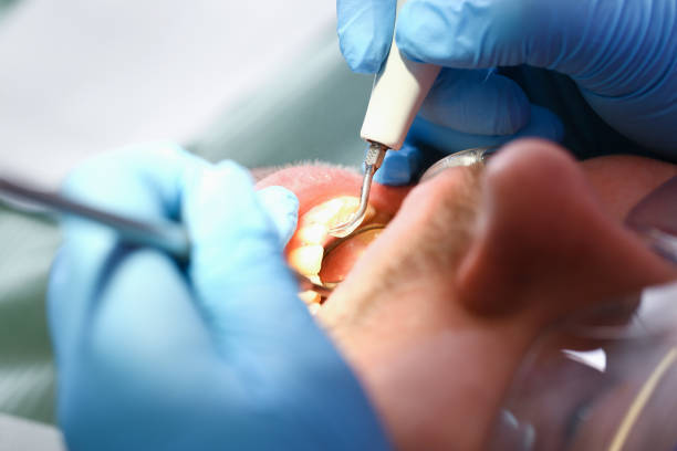 Best Emergency Dental Care for Sports Injuries in Point Baker, FL