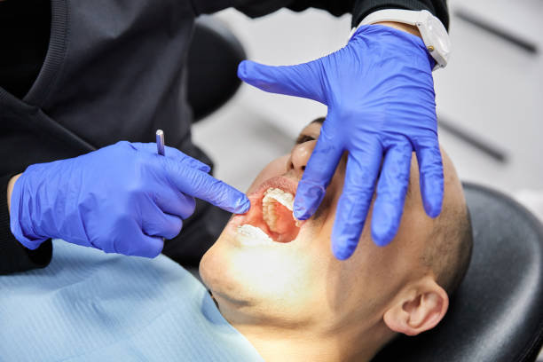 Best Dental Abscess Treatment in Point Baker, FL